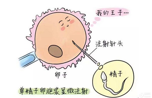 試管嬰兒費用總共多少？三代試管費用會增加嗎？